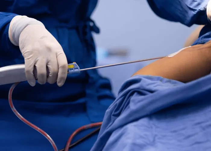 ویژگی کلینیک پیکرتراشی